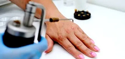 живуть паразити-близнюки