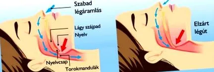 операция операция