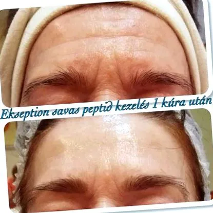 nivelul articular