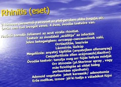 спрете свързано