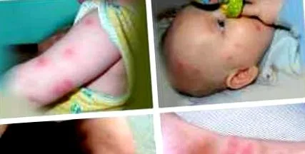 уикипедия