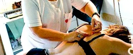 fire acupunctură