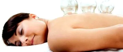 cupping може бъде