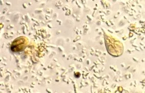 паразитни giardia