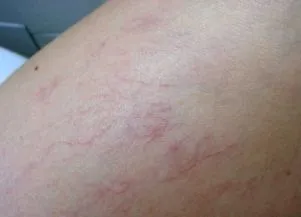 медицински купете