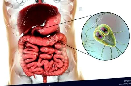 giardiaza helminthic