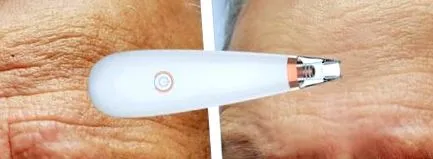 начини начини