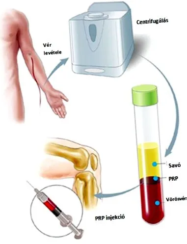 durere injecției