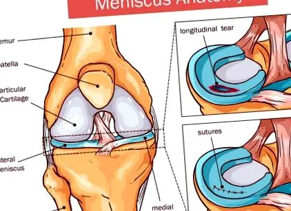 medicație tratamentul