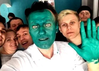 опозиционен опозиционен