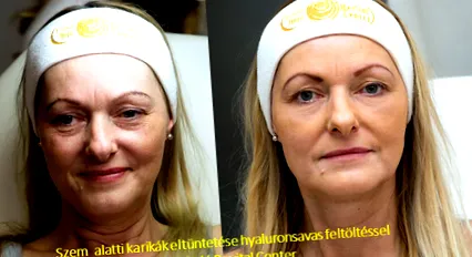 ръководство фокус