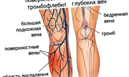 капсули таблетки