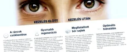 агенти бръчки
