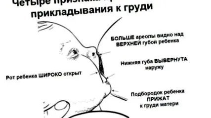 лікування глистів