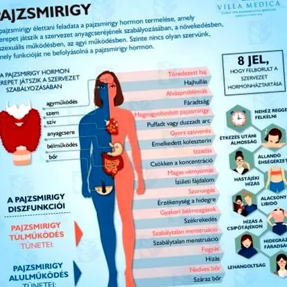 радикулопатія радикулопатія