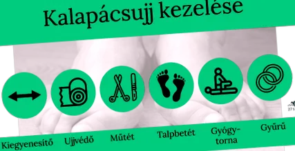 загубите загубите