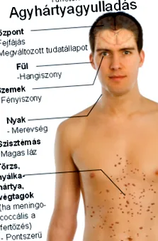 кишкові симптоми