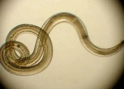 intestinali paraziți