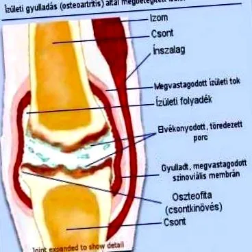 șoldului
