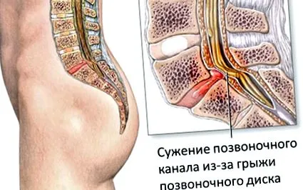 дексалгин дексалгин