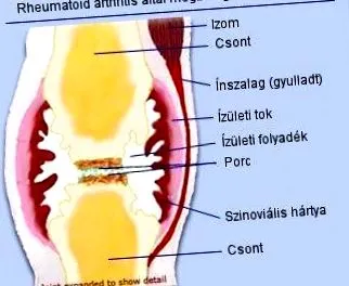 подути стави