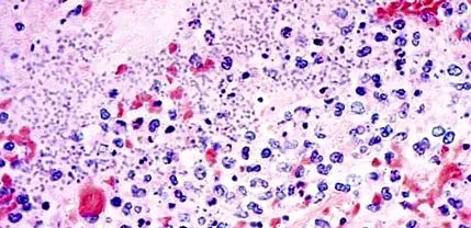giardia кропив