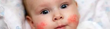 хелминти случва