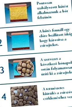 congelare cirololipolismului