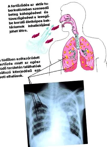 симптоми дітей