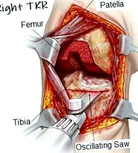 ligamento ligamento
