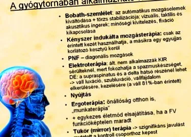 після інсульту зору