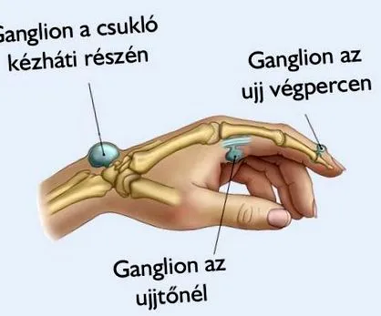tratamentul fără