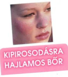 розацеите