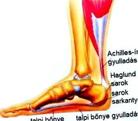 chirurgie tocuri