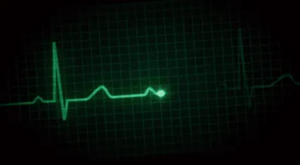 серцевих скорочень