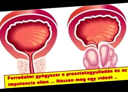 хапчета