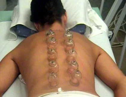 потребителско velashape