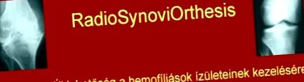 лечението менискус