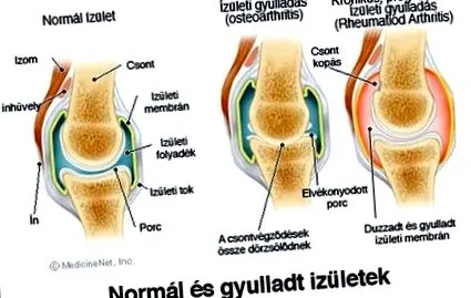 care diferența