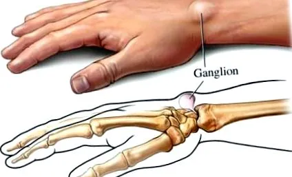 показалеца травма
