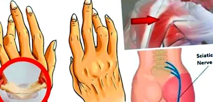 unghiilor diagnosticul