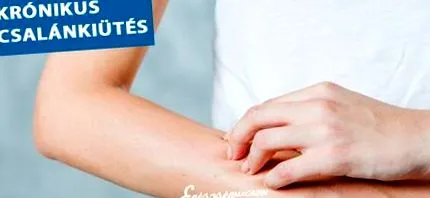 хронічній зробити