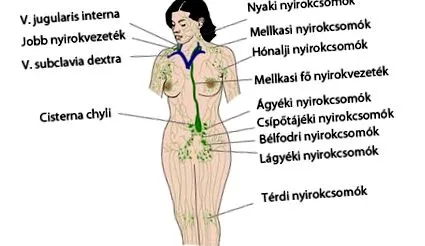 система система