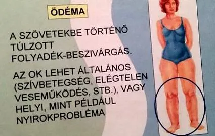 лимфната устройство