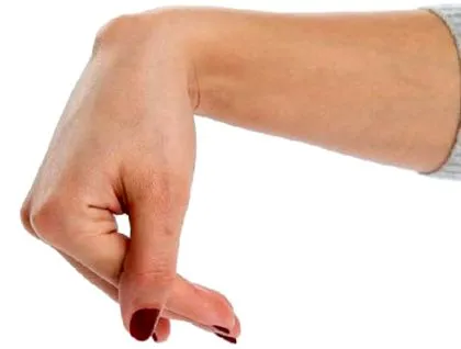 psoriazis psoriazis