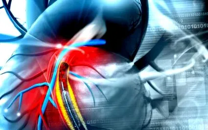cardiocenter имплантация
