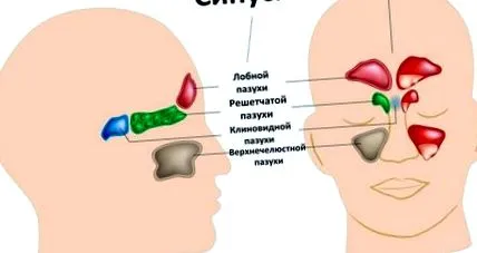 неприємним запахом
