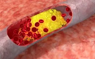 заблуди mmol литър