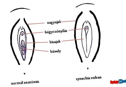 vaginal vaginal