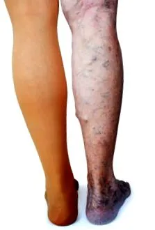 câteva